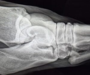Radiografia del garretto, proiezione obliqua